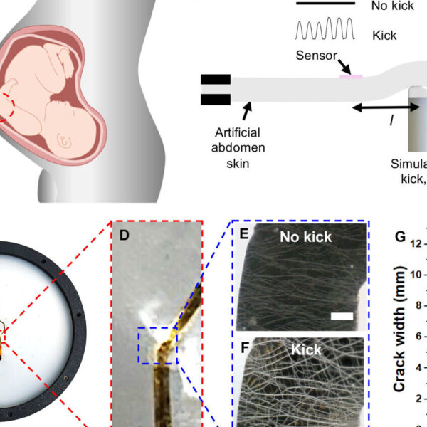 Stick-on patch can monitor a baby’s movements in utero